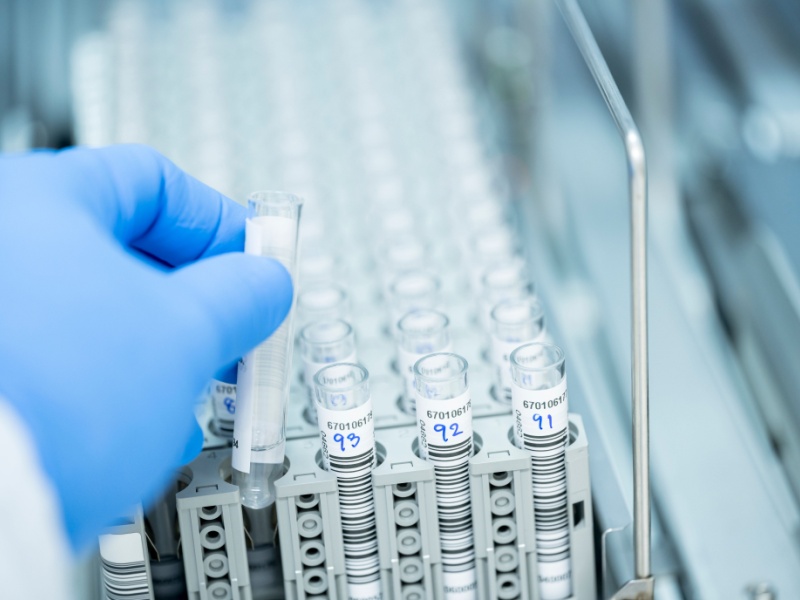 Neutralizing Antibody Sample Testing and Report Harmonization
