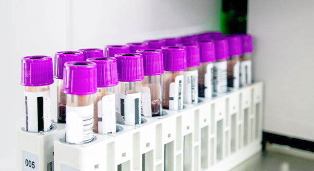 Biomarker Services 